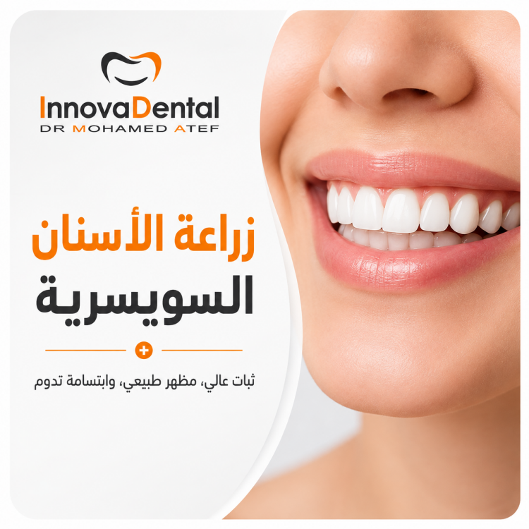 زراعة الاسنان السويسرية: الحل الأمثل لابتسامة تدوم